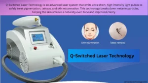 q-switched-laser-technology